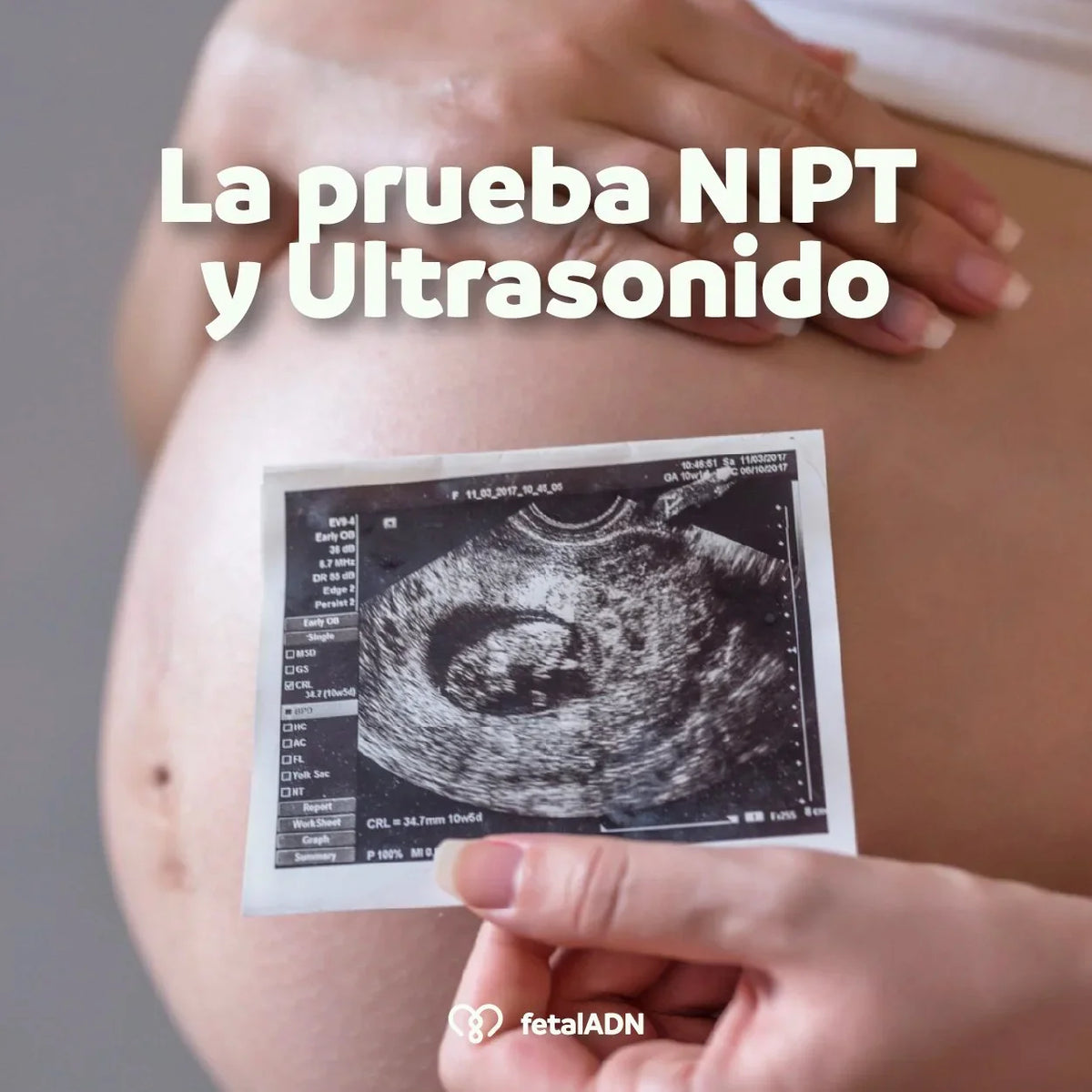 NIPT y Ultrasonido – ¿Qué diferencia hay en el embarazo?