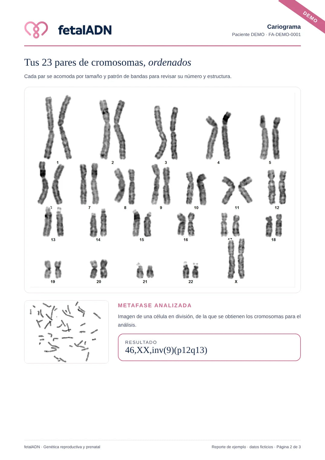 Cariograma: tus 23 pares de cromosomas
